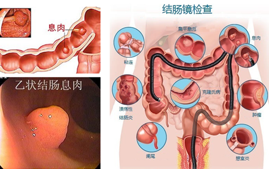 萎縮性胃炎真的“很嚇人”？看完這“七個事實”你就明白了